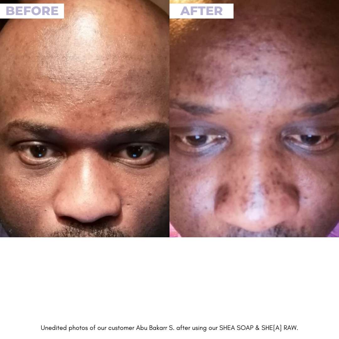 SHEA DUO - Unrefined Riches