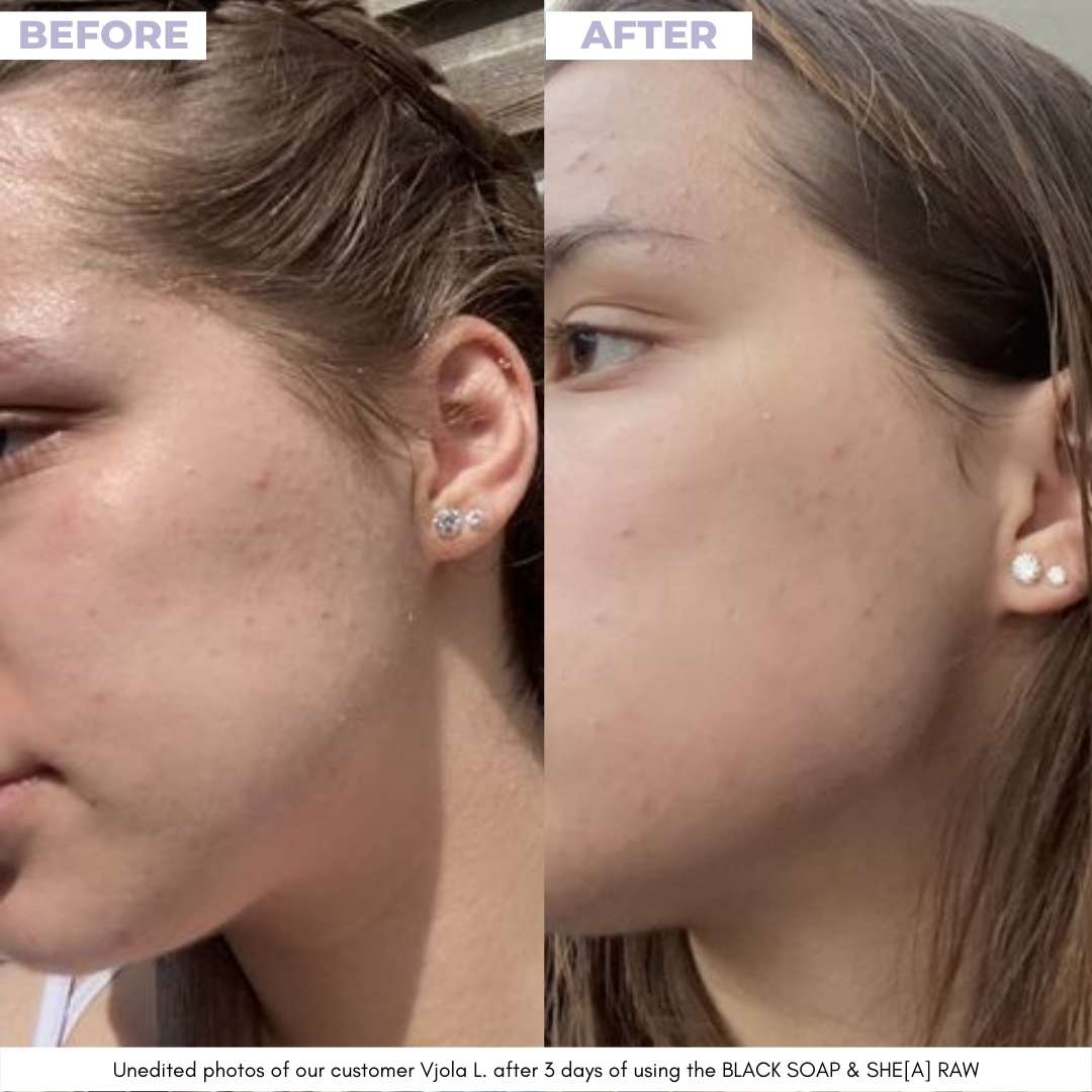 GLOW DUOs - Unrefined Riches